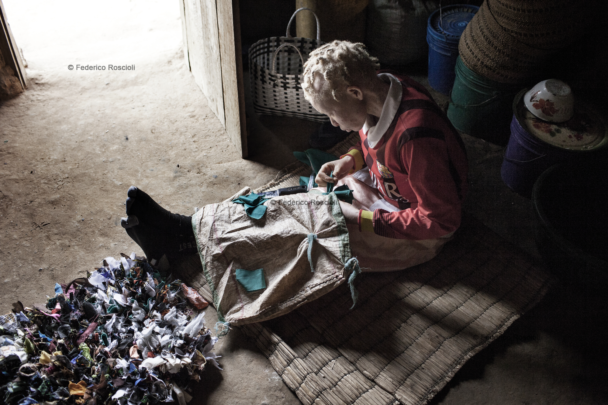 Ilula, Tanzania, July 21, 2014 - Alufema sawing a carpet. She is one of the persons with albinism of the Kilolo District censed by Tulime Association. There have never been killings in this area, so the first enemy of albinos is the sun. The census was fundamental in order to be able to help the albinos of the area with sunscreen cream and medical check-up. The national census does not provide correct and actual data about albinism.