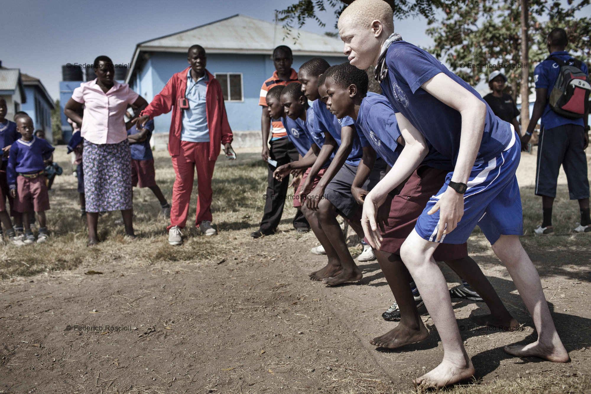 Mwanza, Tanzania, July 10, 2014 - Running race in sport day in Lake View School, Mwanza, Tanzania. In this school Under The Same Sun is full guarantee for 52 children with albinism, this allow them to study in a normal mixed school instead of special centers. In Tanzania albinos are considered disabled, but they just might have sight problems.
