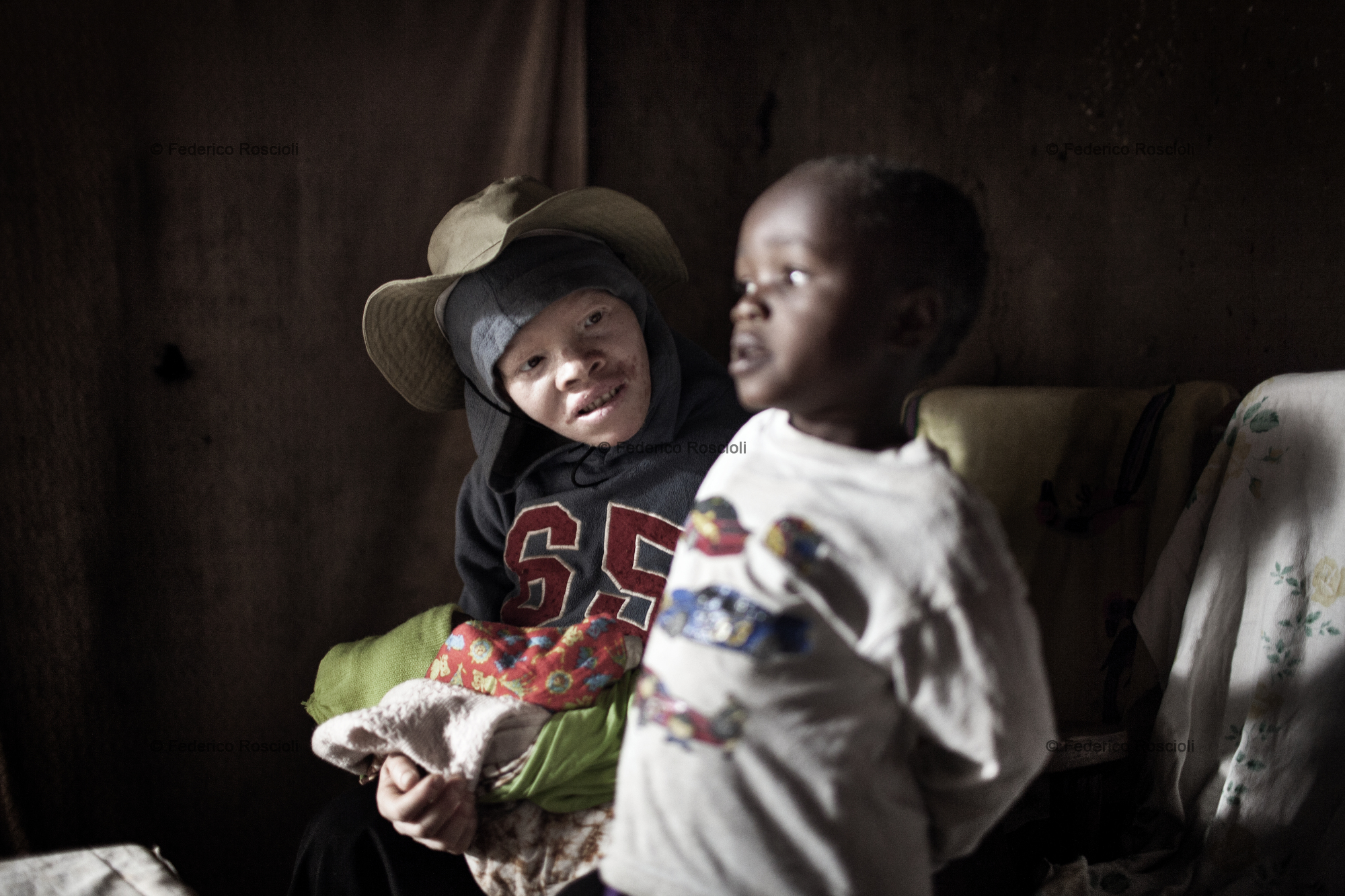 Ilula, Tanzania, July 21, 2014 - Angela with one of her four children, none of them with albinism. She is one of the persons with albinism of the Kilolo District censed by Tulime Association. There have never been killings in this area, so the first enemy of albinos is the sun. The census was fundamental in order to be able to help the albinos of the area with sunscreen cream and medical check-up. The national census does not provide correct and actual data about albinism.