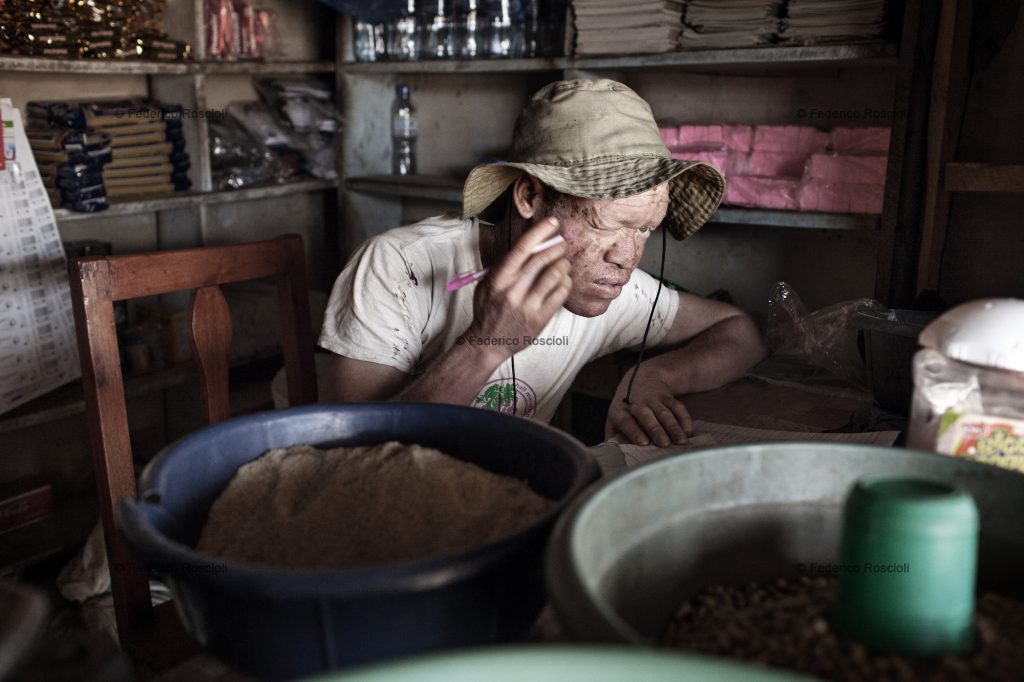 Ilula, Tanzania, July 22, 2014 - Canuti studying in his shop. He managed to have a job that does not require to be under the sun. He is one of the persons with albinism of the Kilolo District censed by Tulime Association. The census was fundamental in order to be able to help the albinos of the area with sunscreen cream and medical check-up. The national census does not provide correct and actual data about albinism.