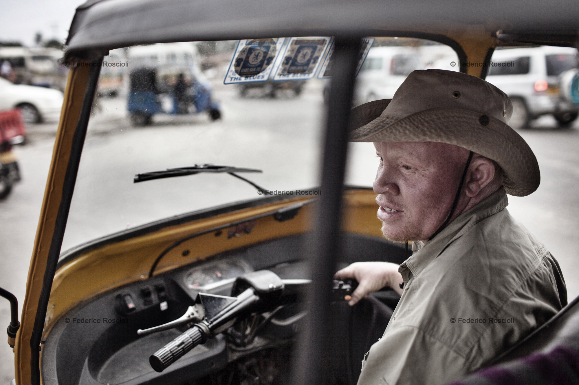 Dar es Salaam, Tanzania, July 29, 2014 - Redman in his room. He is a bajaj driver in Dar es Salaam, Tanzania. Despite albinism, he has been a driver for 9 years, the last 3 on a bajaj. A Bajaj is a three-wheel taxi, perfect to move in Dar traffic. Being covered on the top, it is also a shield from the sun for an albino.